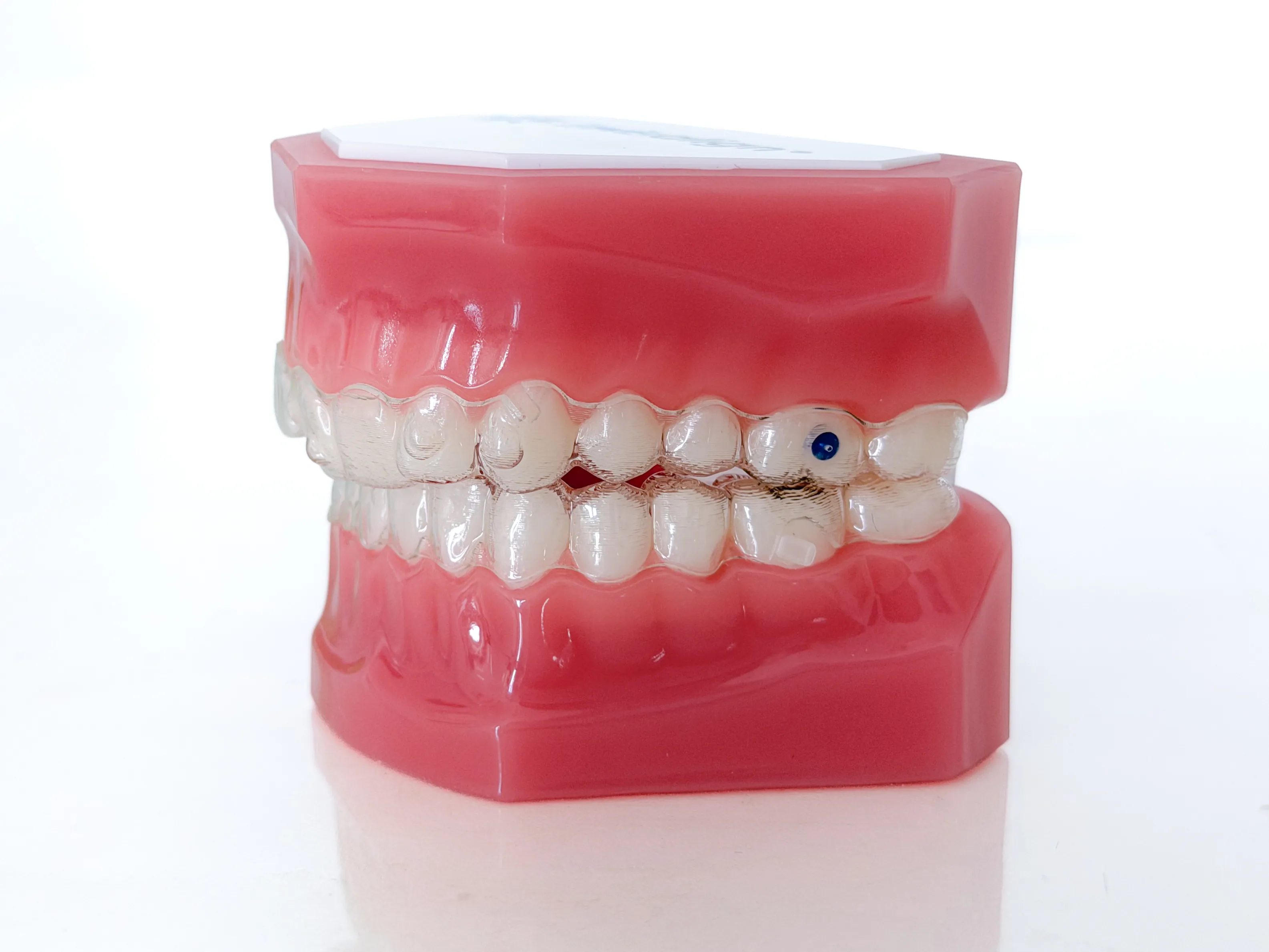 Invisalign